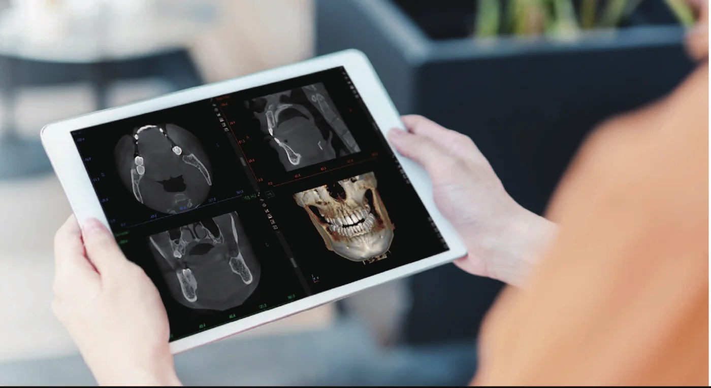 Profesional revisando un estudio CBCT en una tablet